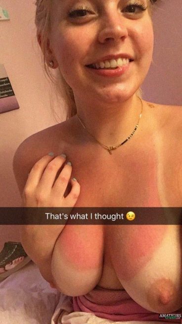 Wife sunburn leaked snapchat nudes ouch